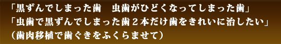 歯科治療プラスαできれいになりたい